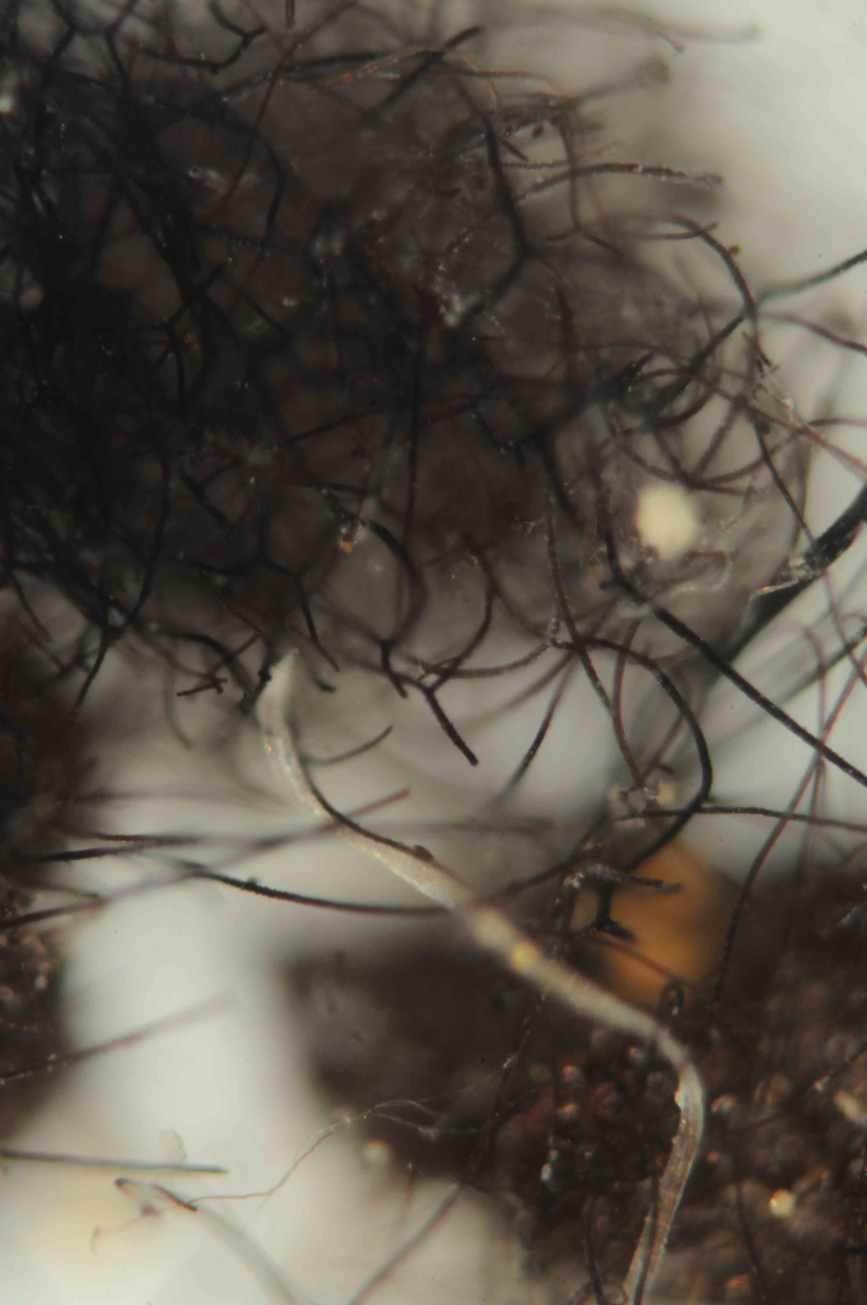 Aiuto riconoscimento spore fungine